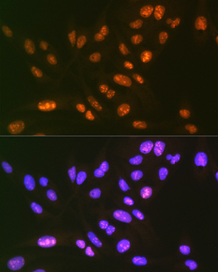 SF3B3/SAP130 Rabbit Monoclonal Antibody - Image 3