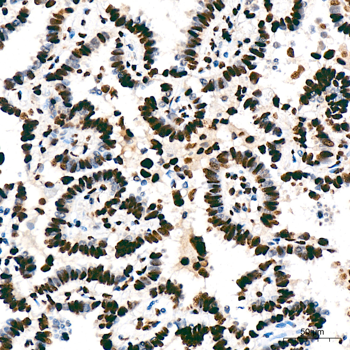 SF3B3/SAP130 Rabbit Monoclonal Antibody - Image 4