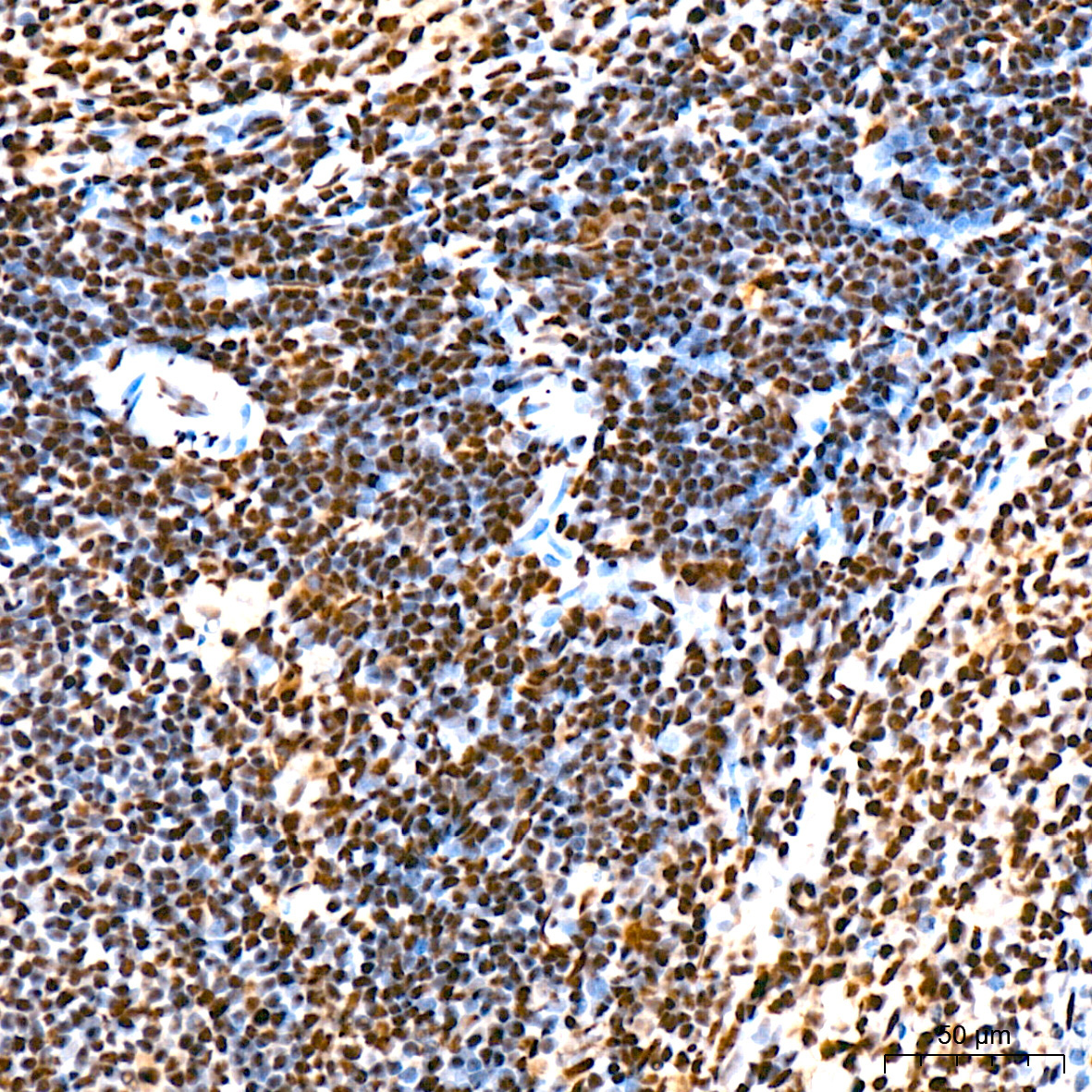 SF3B3/SAP130 Rabbit Monoclonal Antibody - Image 8