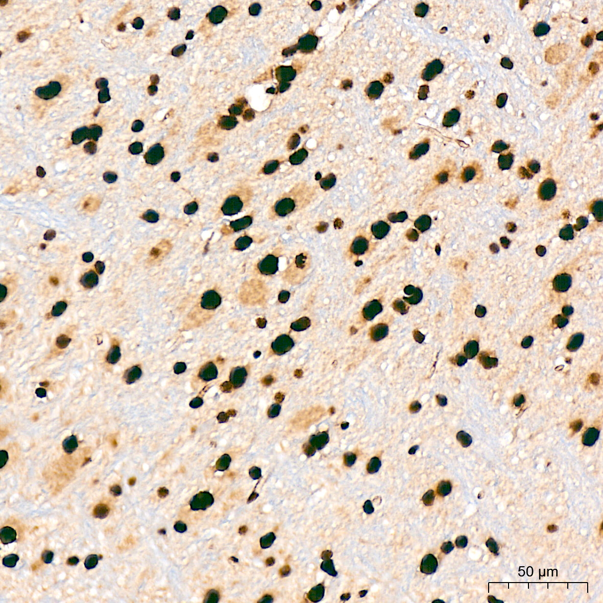 SF3B3/SAP130 Rabbit Monoclonal Antibody - Image 10