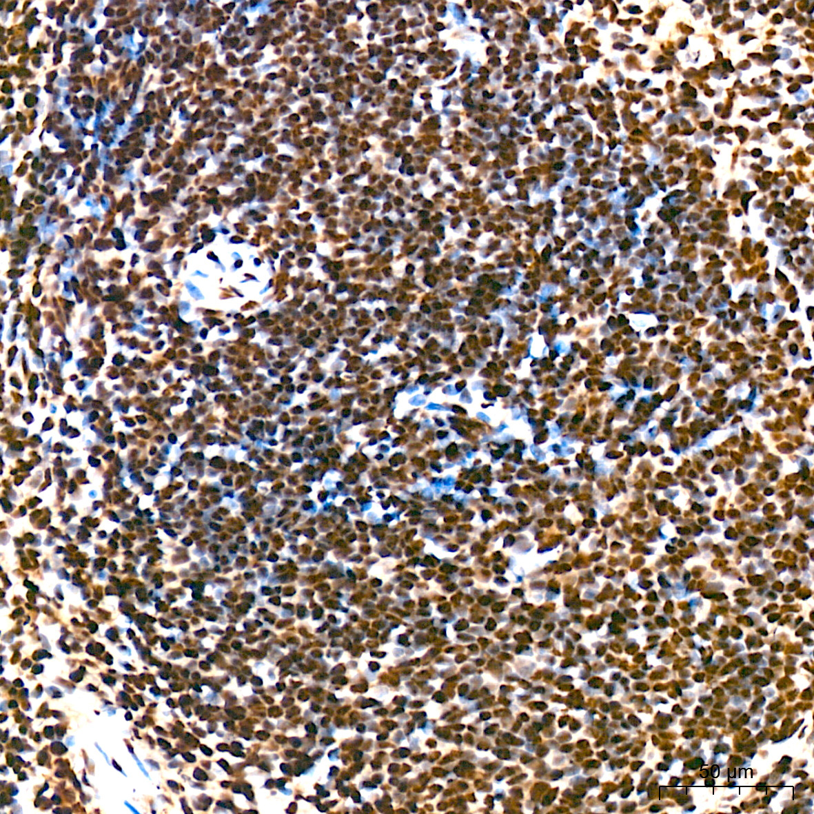 SF3B3/SAP130 Rabbit Monoclonal Antibody - Image 11
