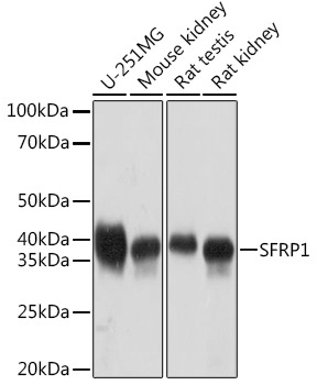 SFRP1 Rabbit Monoclonal Antibody