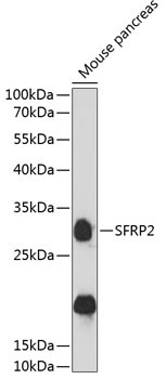 SFRP2 Rabbit Polyclonal Antibody