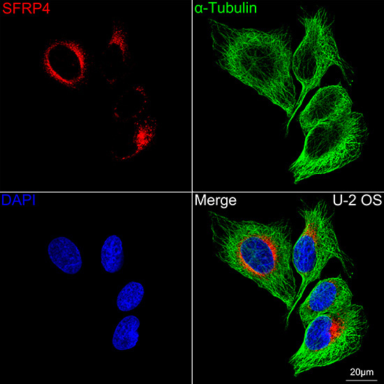 SFRP4 Rabbit Monoclonal Antibody - Image 2