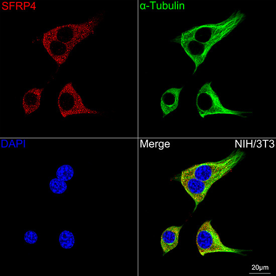 SFRP4 Rabbit Monoclonal Antibody - Image 3