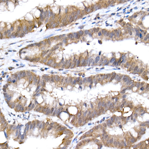 SFT Rabbit Monoclonal Antibody