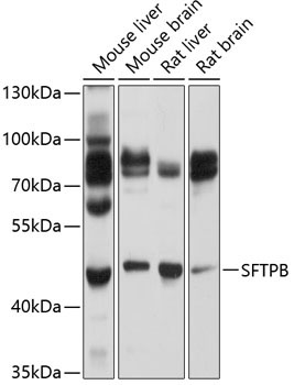 SFTPB Rabbit Polyclonal Antibody