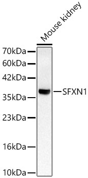 SFXN1 Rabbit Polyclonal Antibody