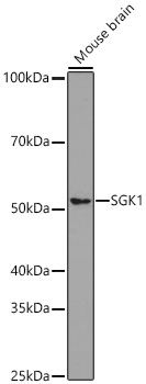 SGK1 Rabbit Monoclonal Antibody