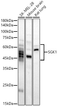 SGK1 Rabbit Polyclonal Antibody