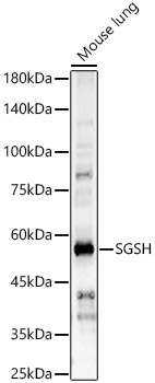 SGSH Rabbit Polyclonal Antibody