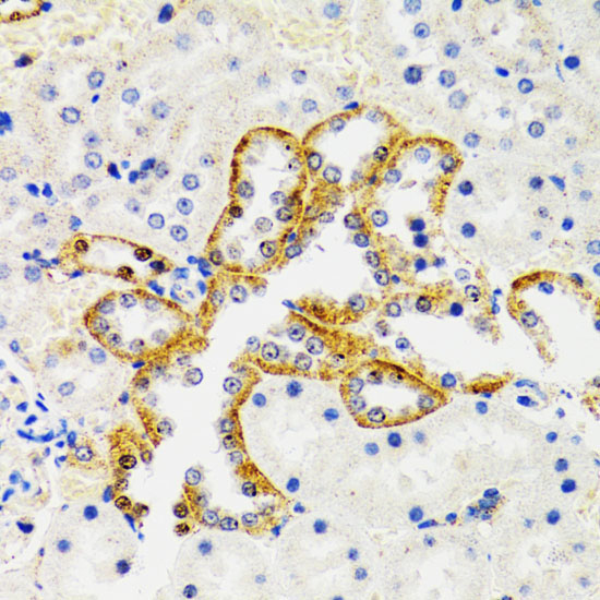 SH2B1 Rabbit Polyclonal Antibody