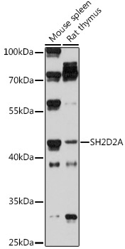 SH2D2A Rabbit Polyclonal Antibody
