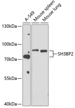 SH3BP2 Rabbit Polyclonal Antibody
