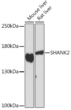 SHANK2 Rabbit Polyclonal Antibody