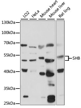 SHB Rabbit Polyclonal Antibody