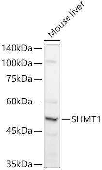 SHMT1 Rabbit Polyclonal Antibody