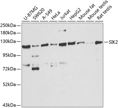 SIK2 Rabbit Polyclonal Antibody