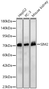 SIM2 Rabbit Polyclonal Antibody