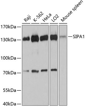 SIPA1 Rabbit Polyclonal Antibody
