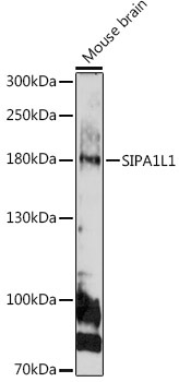 SIPA1L1 Rabbit Polyclonal Antibody