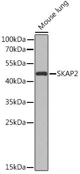 SKAP2 Rabbit Polyclonal Antibody