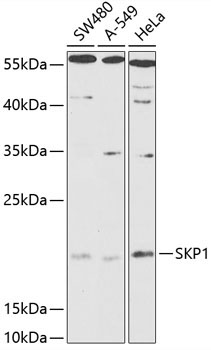 SKP1 Rabbit Polyclonal Antibody