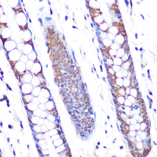 SKP2 Rabbit Monoclonal Antibody - Image 2