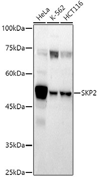 SKP2 Rabbit Polyclonal Antibody