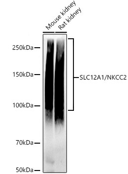 SLC12A1 / NKCC2 Rabbit Monoclonal Antibody