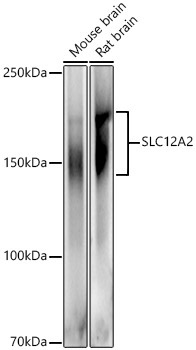 SLC12A2 Rabbit Polyclonal Antibody