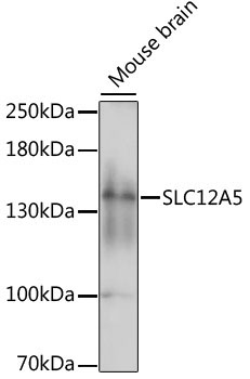 SLC12A5 Rabbit Polyclonal Antibody