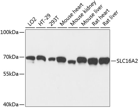 SLC16A2 Rabbit Polyclonal Antibody