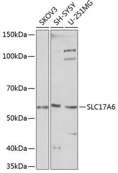 SLC17A6 Rabbit Polyclonal Antibody