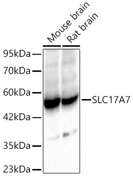 SLC17A7 Rabbit Polyclonal Antibody