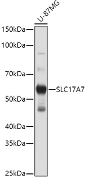 SLC17A7 Rabbit Polyclonal Antibody