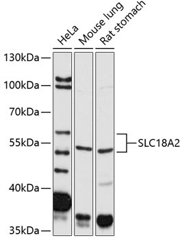 SLC18A2 Rabbit Polyclonal Antibody