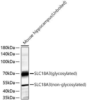 SLC18A3 Rabbit Polyclonal Antibody