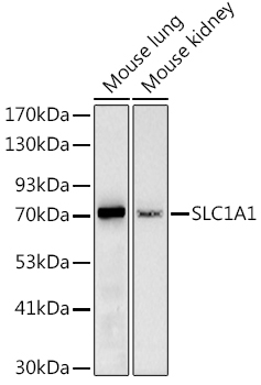 SLC1A1 Rabbit Polyclonal Antibody
