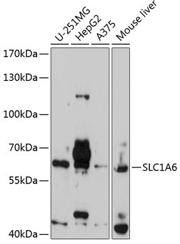 SLC1A6 Rabbit Polyclonal Antibody
