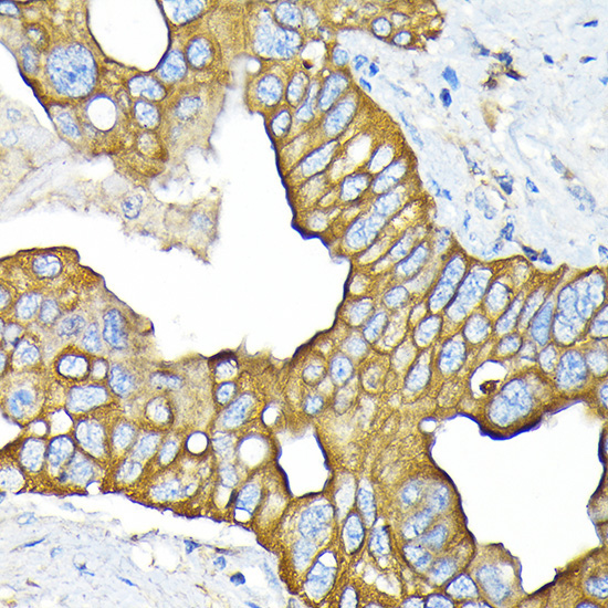 SLC22A3/OCT3 Rabbit Monoclonal Antibody - Image 2