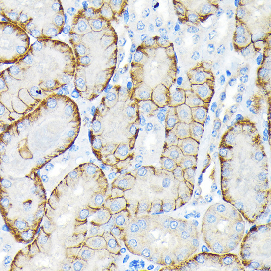 SLC22A3/OCT3 Rabbit Monoclonal Antibody - Image 3