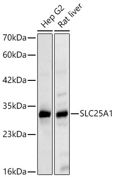 SLC25A1 Rabbit Polyclonal Antibody