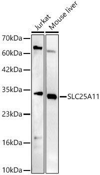 SLC25A11 Rabbit Polyclonal Antibody