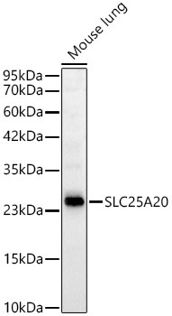 SLC25A20 Rabbit Monoclonal Antibody