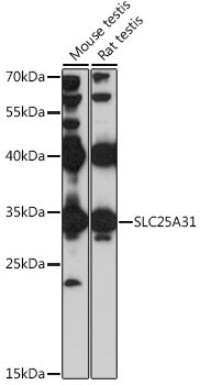 SLC25A31 Rabbit Polyclonal Antibody