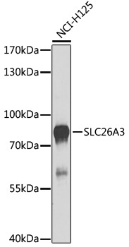SLC26A3 Rabbit Polyclonal Antibody