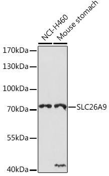 SLC26A9 Rabbit Polyclonal Antibody