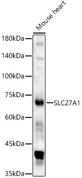 SLC27A1 Rabbit Polyclonal Antibody