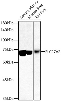 SLC27A2 Rabbit Polyclonal Antibody